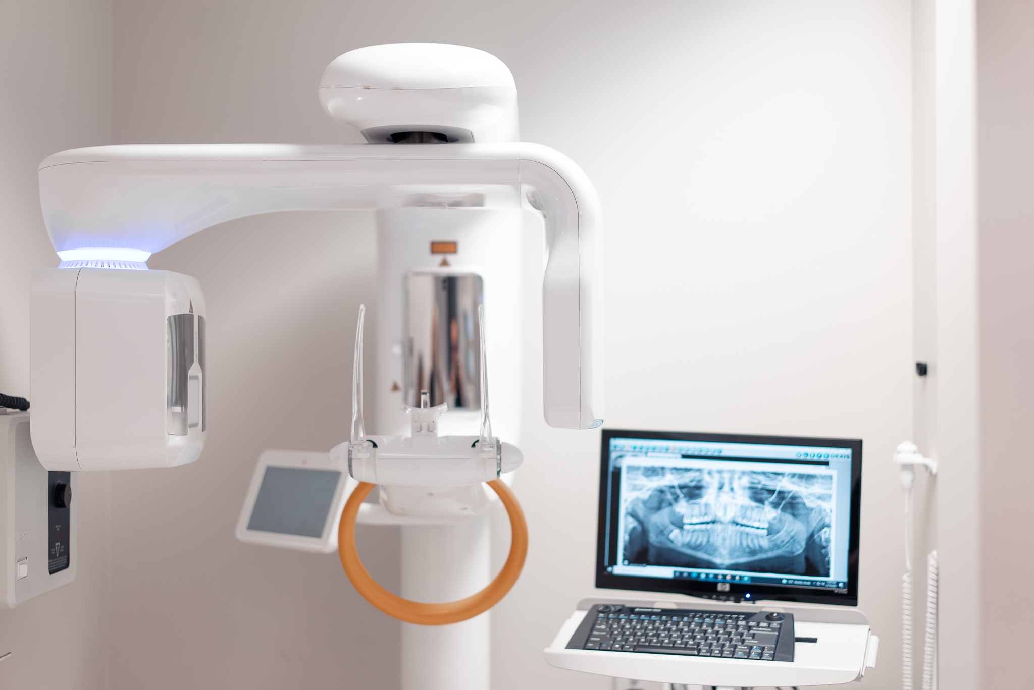 Technology Panorex machine_ X-ray showing Wisdom Teeth